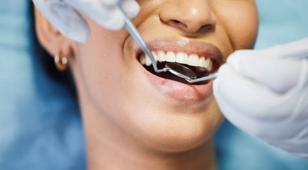 Best Cosmetic Emergency Dentistry in Artondale, WA